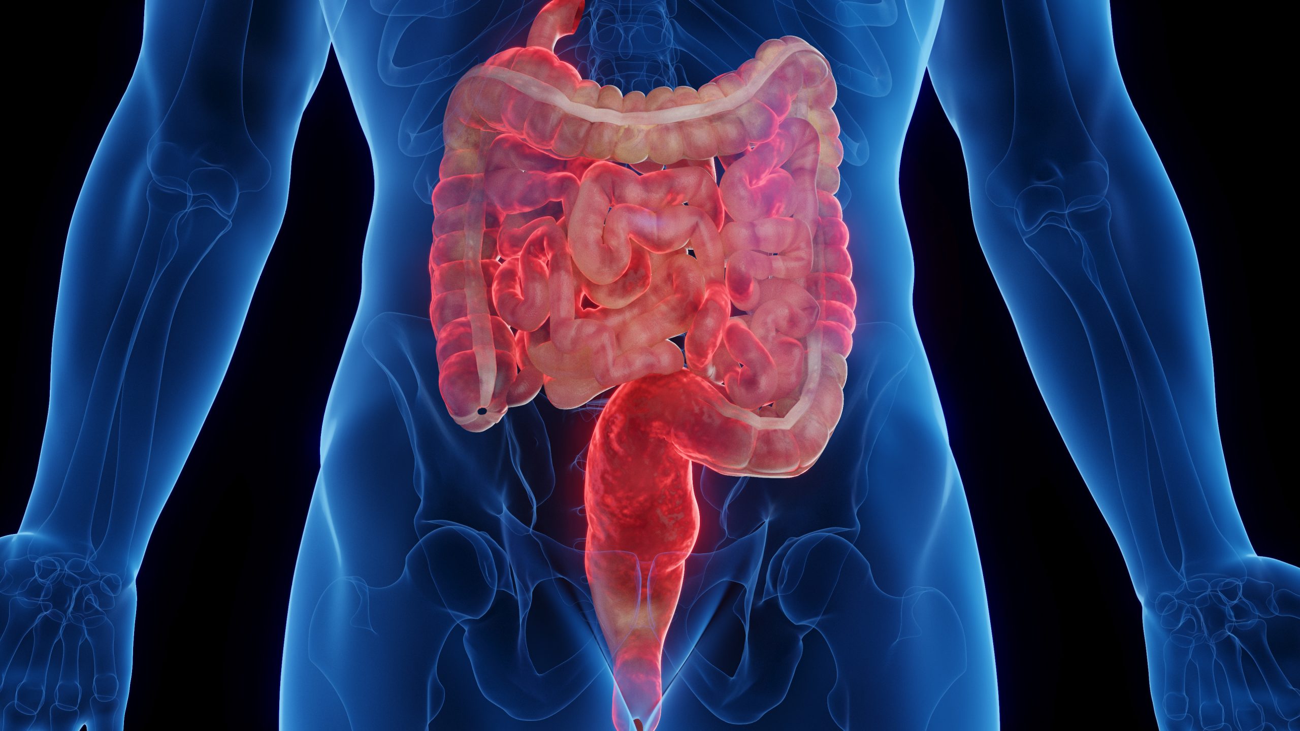 CROHN  HASTALIĞI