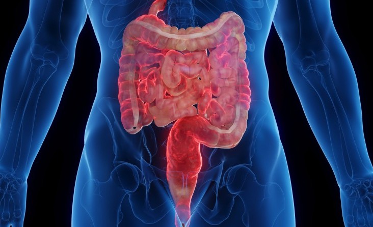 CROHN  HASTALIĞI