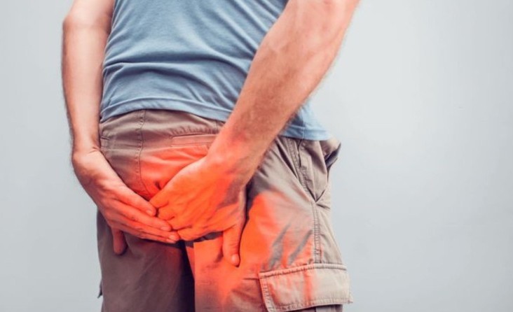 ANAL APSE VE ANAL FİSTÜL