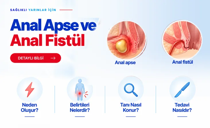 Anal Apse ve Anal Fistül