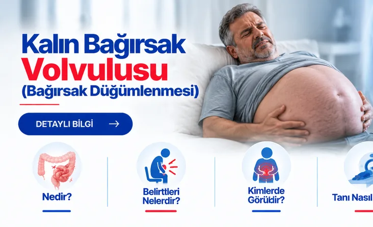 Kalın Bağırsak Volvulusu (Bağırsak Düğümlenmesi)