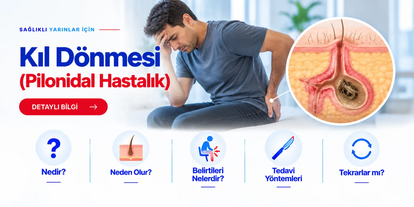 Kıl Dönmesi (Pilonidal Hastalık) – hasta bilgilendirme görseli