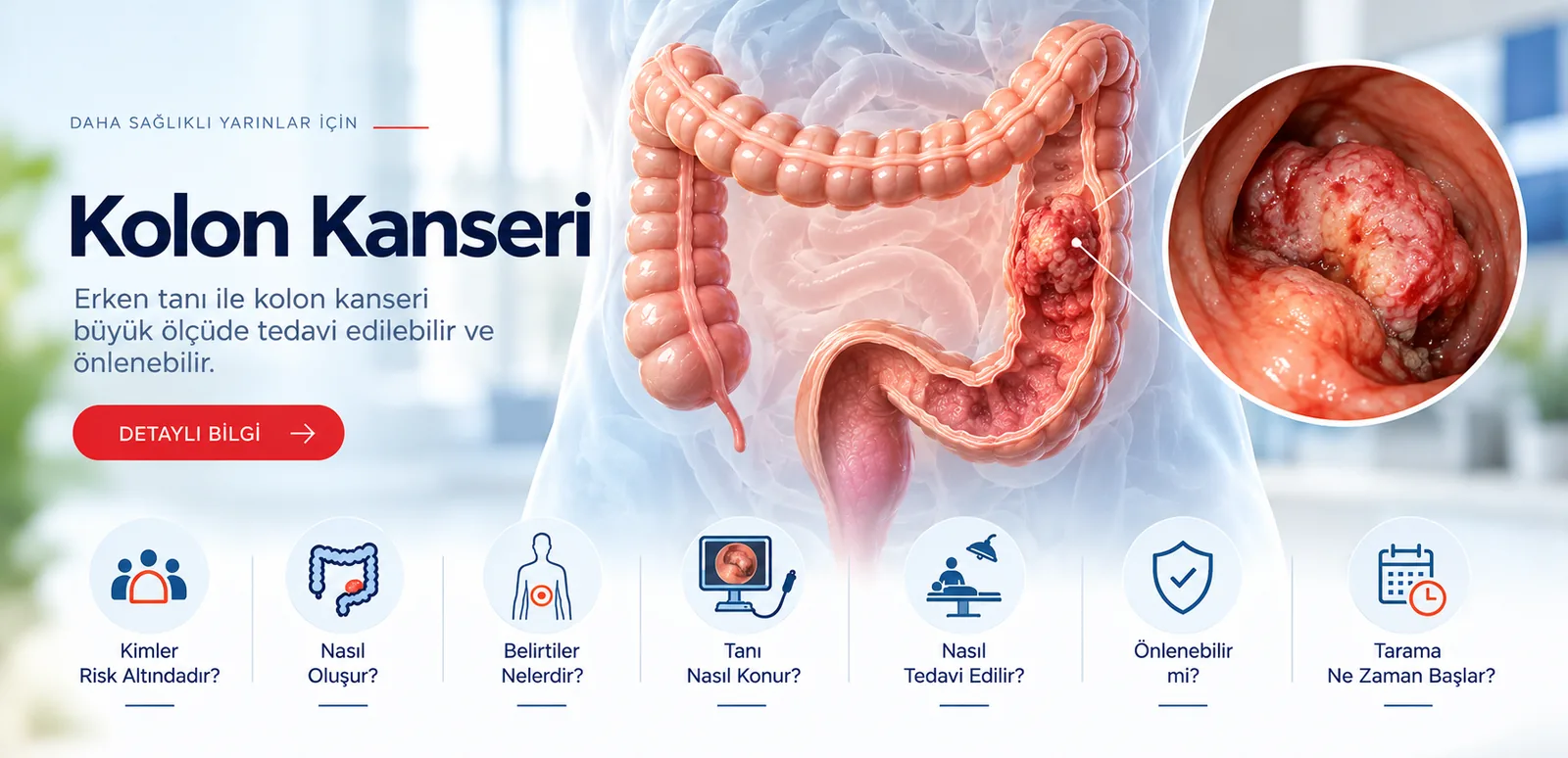 Kolon Kanseri – hasta bilgilendirme görseli