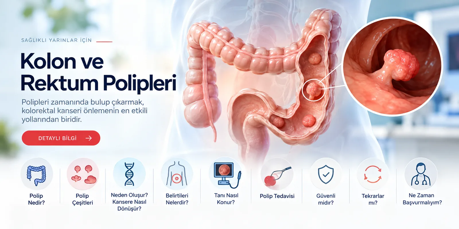 Kolon ve Rektum Polipleri – hasta bilgilendirme görseli